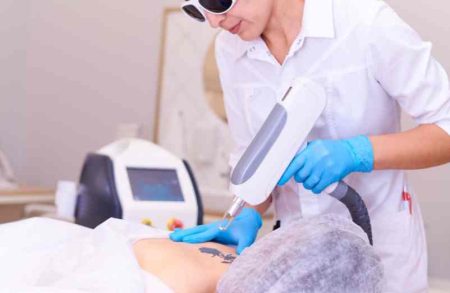 Détatouage avant/après : tout sur les précautions à prendre