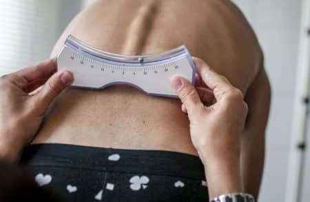 Les premiers signes de scoliose chez un enfant
