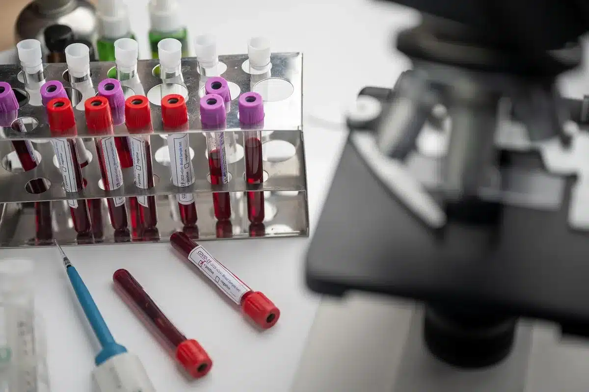 Fichier et diagramme montrant empreinte carbone liée à un projet de santé